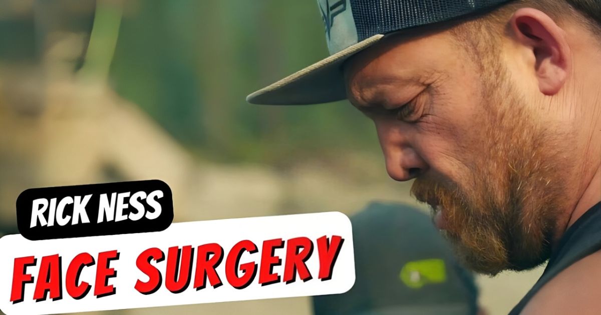 What happened to Rick Ness Nose? A Look Into the Reality